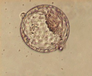 view Human blastocyst within the zona pellucida