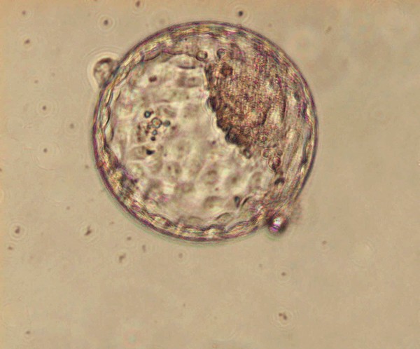 Human blastocyst within the zona pellucida