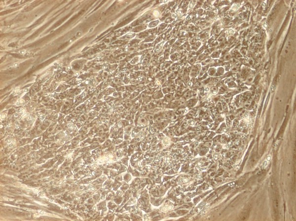 Human embryonic stem cells