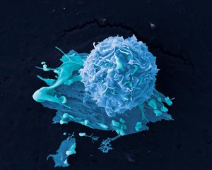 view Breast cancer cells