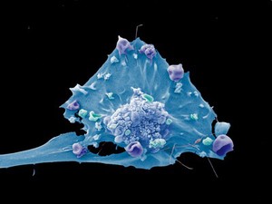 view Breast cancer cell