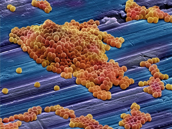 MRSA