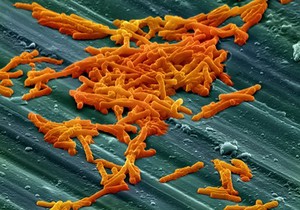 view Clostridium difficile