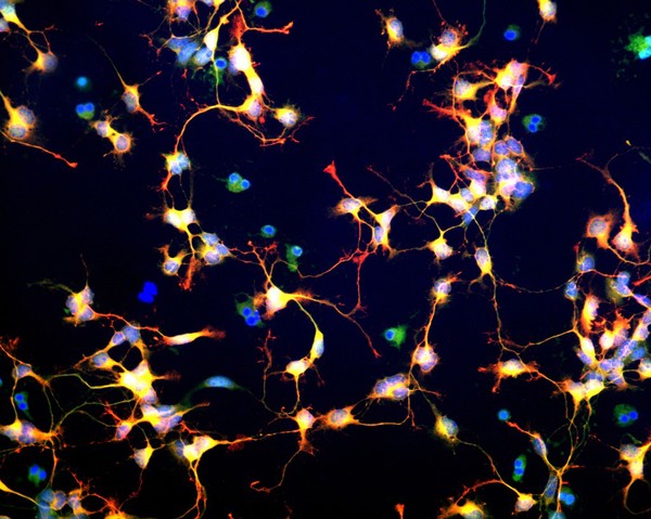 Differentiating neuroblasts