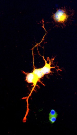 view Differentiating neuroblast