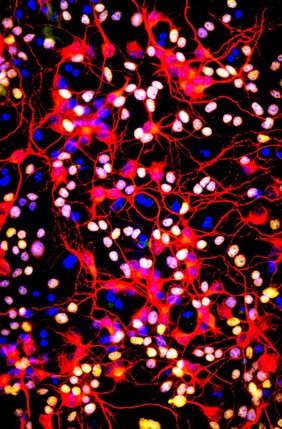 Neurons and oligodendrocytes