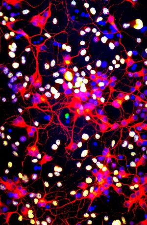 view Neurons and oligodendrocytes