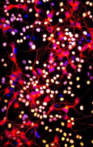 view Neurons and oligodendrocytes