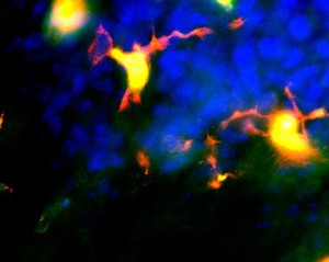 view Oligodendrocyte precursor cells (orange and yellow) in their zone of origin within the spinal cord.