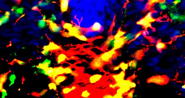 Oligodendrocyte precursor cells (red and yellow) in their zone of origin within the spinal cord.