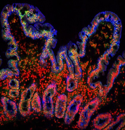 Villi from the small intestine
