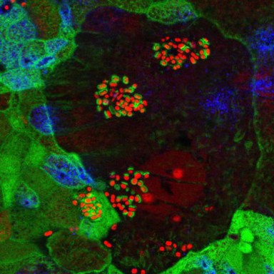 Enteropathogenic E. coli on human intestinal cells