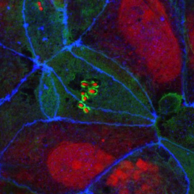 Enteropathogenic E. coli on human intestinal cells