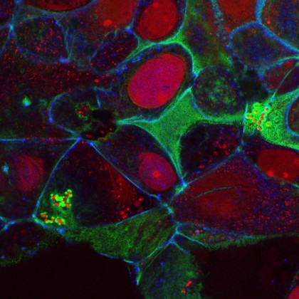 Enteropathogenic E. coli on human intestinal cells