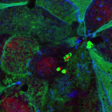 Enteropathogenic E. coli on human intestinal cells