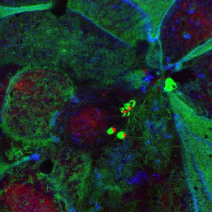Enteropathogenic E. coli on human intestinal cells