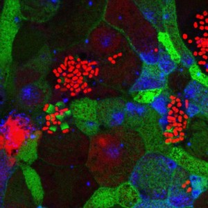 view Enteropathogenic E. coli on human intestinal cells