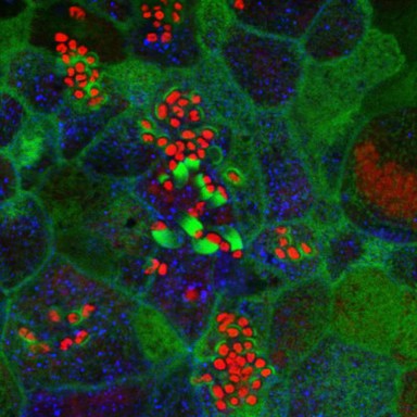 Enteropathogenic E. coli on human intestinal cells
