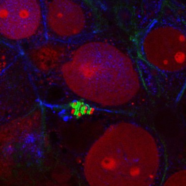 Enteropathogenic E. coli on human intestinal cells