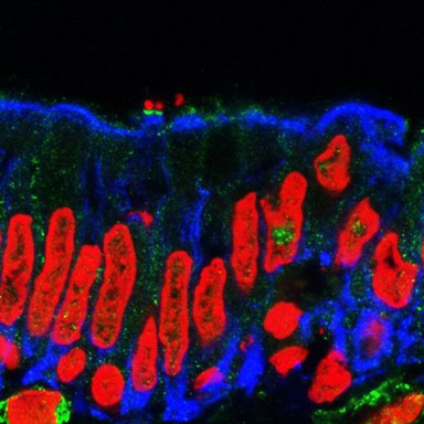 Pathogenic E. coli on the intestinal lining