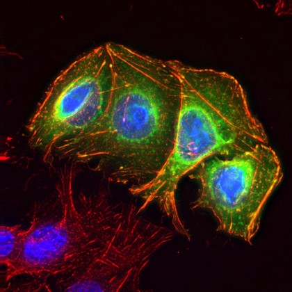 Colon cancer cells
