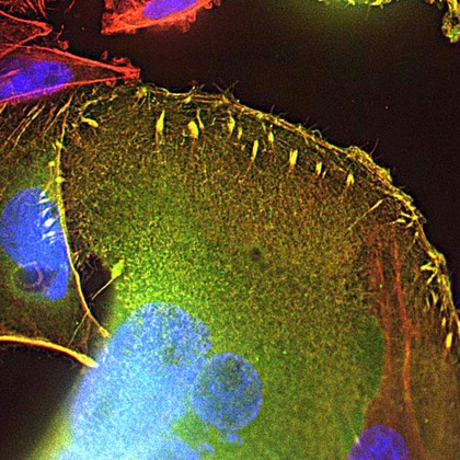Colon cancer cells