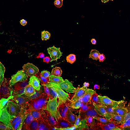 Colon cancer cells