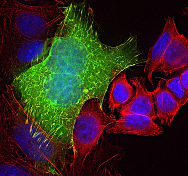 Colon cancer cells