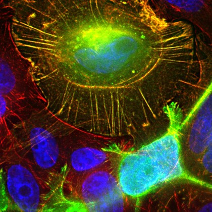 Colon cancer cells
