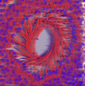 view Seminiferous tubule