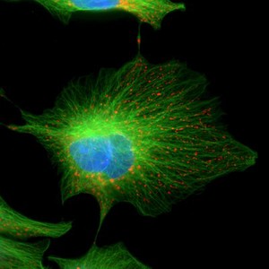 view Cell showing tubulin and mitochondria