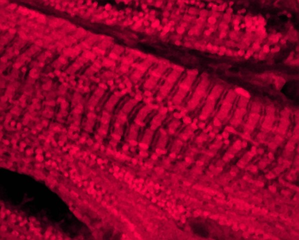 Cardiac muscle stained for mitochondria. Mitochondria provide the energy to power contraction of the muscle.