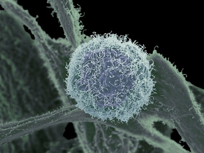 Skin cancer cell