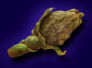 view Seed head of a thuja tree. This plant has natural antimicrobial properties and is used in a variety of preparations for wart removal, thrush, and ringworm.