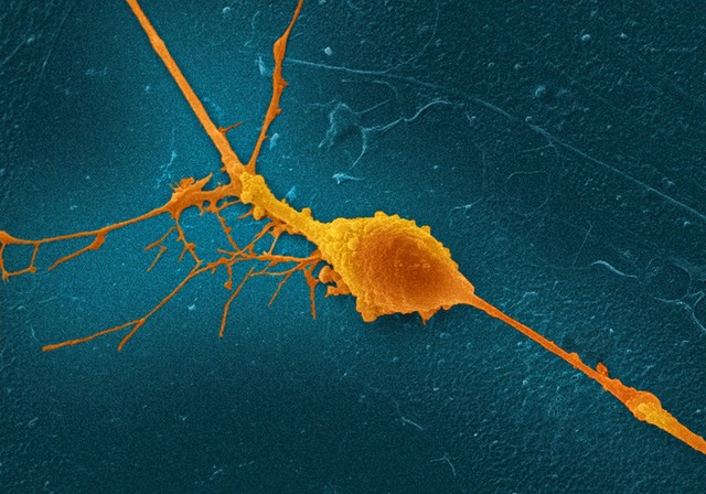 Retinal ganglion cell