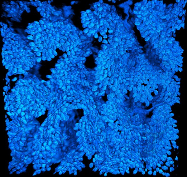 villi of small intestine