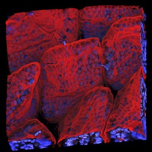 view Villi in the small intestine