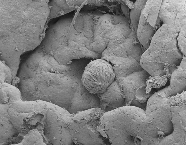 Indigestible particle of food