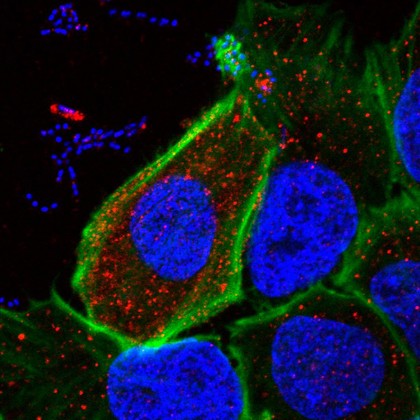 Human epithelial cells infected with E. coli