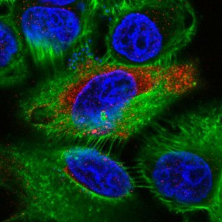 Human epithelial cells infected with E. coli