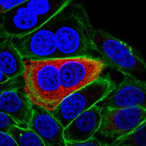 view Human epithelial cells infected with E. coli