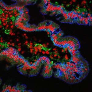 view Villi from the small intestine