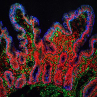 Villi from the small intestine