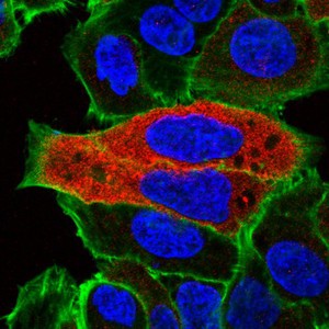 view Shiga toxin uptake by human epithelial cells