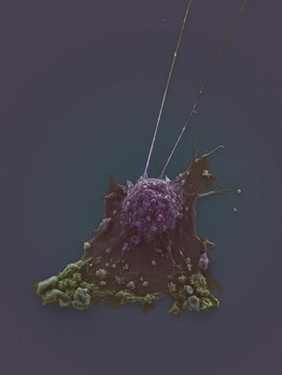 coloured breast cancer cell