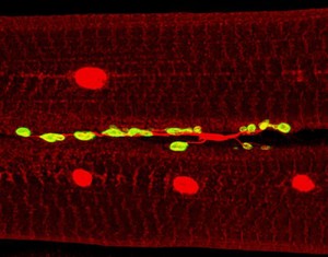 view Neuromuscular Junction from Drosophila