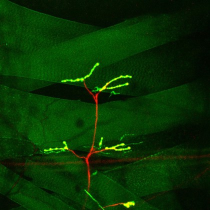 Muscle Innervation