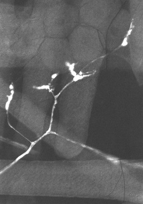 Muscle Innervation in Drosophila