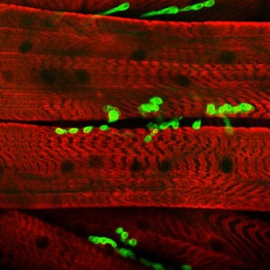 view Neuromuscular junction showing the association of the nerves and the muscle fibres. This image is taken from a Drosophila larva and shows the neuromuscular junctions stained with green fluorescence protein (GFP) in association with the muscle fibres in red. The muscle is stained with an antibody which provides the red colour and also shows the striated pattern of the contractile filaments (sarcomers) of the muscle.