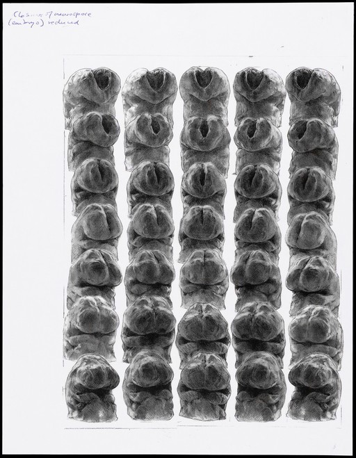 Closure of the neuropore